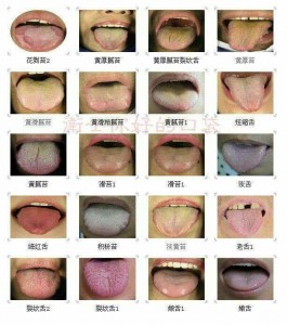 Diagnosticos de la Medicina China,